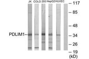 Western blot analysis of extracts from Jurkat/COLO205/293/HepG2/HuvEc cells, using PDLIM1 Antibody. (PDLIM1 抗体  (AA 61-110))