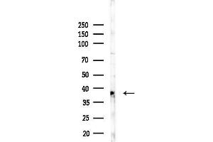 Western blot analysis of lysates from EC304 cells, using TAS2R14 Antibody at 1/1000 dilution.
