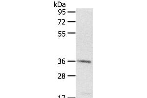 Western Blot analysis of A431 cell using PDLIM4 Polyclonal Antibody at dilution of 1:400 (PDLIM4 抗体)