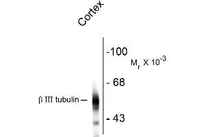Western blots of rat cortex lysate showing specific immunolabeling of the ~55k beta III tubulin protein. (TUBB3 抗体)