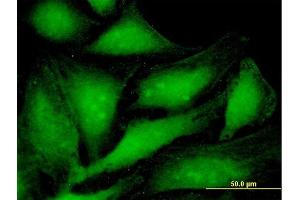 Immunofluorescence (IF) image for anti-Proteasome (Prosome, Macropain) Activator Subunit 1 (PA28 Alpha) (PSME1) (AA 1-249) antibody (ABIN519415)