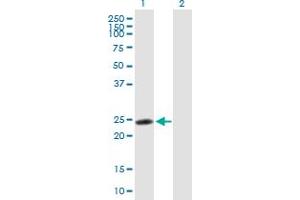 Western Blot analysis of RNF114 expression in transfected 293T cell line by RNF114 MaxPab polyclonal antibody. (RNF114 抗体  (AA 1-228))