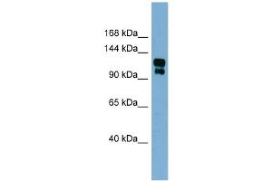 WB Suggested Anti-TRPA1 Antibody Titration:  0. (TRPA1 抗体  (Middle Region))