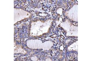 IHC analysis of SLU7 using anti-SLU7 antibody (ABIN7601697).