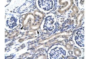 TRAFD1 antibody was used for immunohistochemistry at a concentration of 4-8 ug/ml to stain Epithelial cells of renal tubule (lndicated with Arrows] in Human Kidney. (TRAFD1 抗体  (C-Term))