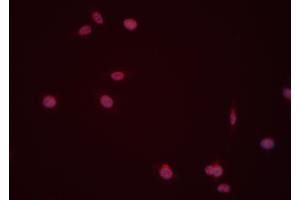 ABIN6274008 staining Hela cells by IF/ICC. (DUSP6 抗体  (Internal Region))