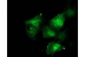 Anti-BCAR1 mouse monoclonal antibody (ABIN2454370) immunofluorescent staining of COS7 cells transiently transfected by pCMV6-ENTRY BCAR1 (RC209133). (BCAR1 抗体)