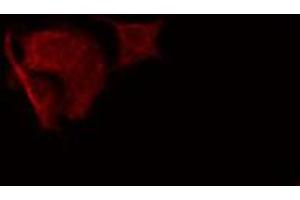 ABIN6274835 staining HeLa cells by IF/ICC. (SGCA 抗体  (Internal Region))