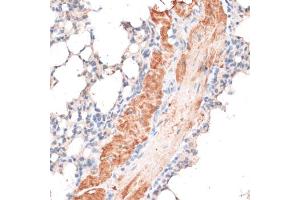 Immunohistochemistry of paraffin-embedded mouse lung using ABCB7 antibody. (ABCB7 抗体)