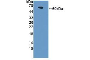 Detection of Recombinant LRP4, Human using Polyclonal Antibody to Low Density Lipoprotein Receptor Related Protein 4 (LRP4) (LRP4 抗体  (AA 1610-1885))