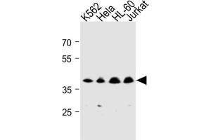 Western Blotting (WB) image for anti-Mitochondrial Trans-2-Enoyl-CoA Reductase (MECR) antibody (ABIN3004507) (MECR 抗体)