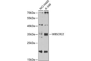 Western blot analysis of extracts of various cell lines, using WBSCR22 antibody (ABIN6132946, ABIN6150175, ABIN6150176 and ABIN6223157) at 1:1000 dilution. (WBSCR22 抗体  (AA 1-281))
