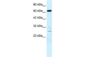 WB Suggested Anti-CRSP6 Antibody Titration:  0. (MED17 抗体  (N-Term))