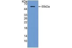 Detection of Recombinant ADP, Porcine using Polyclonal Antibody to Adiponectin (ADPN) (ADIPOQ 抗体  (AA 17-243))