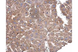 Immunohistochemistry (IHC) image for anti-Calcium/calmodulin-Dependent Protein Kinase ID (CAMK1D) antibody (ABIN2856619)