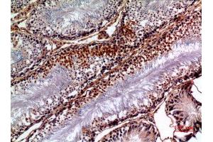 Immunohistochemistry (IHC) analysis of paraffin-embedded Rat Testis, antibody was diluted at 1:100. (PNPLA6 抗体  (Internal Region))