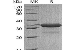 Western Blotting (WB) image for Insulin-Like Growth Factor Binding Protein 7 (IGFBP7) protein (His tag) (ABIN7320822)