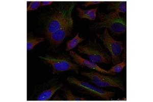 Image no. 2 for anti-Adducin 1 (Alpha) (ADD1) (Ser726) antibody (ABIN197406) (alpha Adducin 抗体  (Ser726))