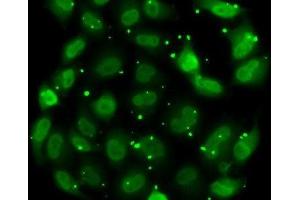 Immunofluorescence analysis of MCF7 cells using DR1 Polyclonal Antibody (DR1 抗体)