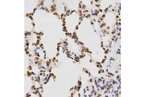 Immunohistochemistry (IHC) image for anti-Histone 3 (H3) (H3K9me3) antibody (ABIN3016030)
