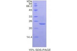 SDS-PAGE analysis of Mouse PTGS1 Protein. (PTGS1 蛋白)