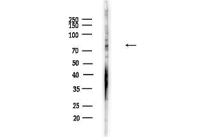 Western blot analysis of lysates from F10-LUC cells(heat-shock,45 min treatment), using Phospho-pan-FOXO1/3/4 (Thr24/Thr32) Antibody at 1/1000 dilution.