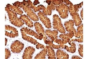Formalin-fixed, paraffin-embedded human stomach stained with MUC5AC antibody (MUC5AC/917 + 45M1). (MUC5AC 抗体)