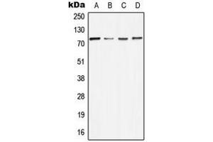 Western blot analysis of MELK expression in MCF7 (A), NIH3T3 (B), mouse liver (C), rat liver (D) whole cell lysates. (MELK 抗体  (Center))