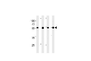 TPIPb Antibody (C-term) ABIN1882284 western blot analysis in 293,A431,,mouse NIH/3T3 cell line lysates (35 μg/lane). (TPTE2 抗体)