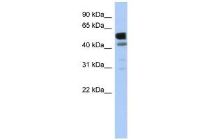 LDHD antibody used at 1 ug/ml to detect target protein. (LDHD 抗体  (Middle Region))