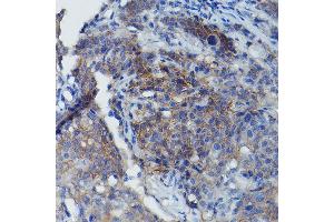 Immunohistochemistry (IHC) image for anti-Basigin (Ok Blood Group) (BSG) (AA 30-200) antibody (ABIN1512647)