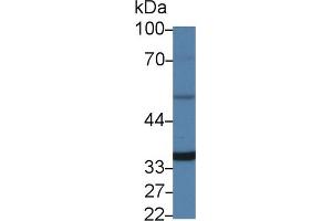 Detection of AIM2 in Porcine Heart lysate using Polyclonal Antibody to Absent In Melanoma 2 (AIM2) (AIM2 抗体  (AA 1-343))