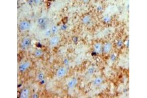 IHC-P analysis of Brain tissue, with DAB staining. (Neurotrypsin 抗体  (AA 153-399))