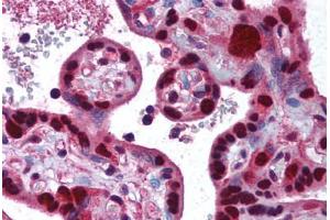 Human Placenta (formalin-fixed, paraffin-embedded) stained with DNMT1 antibody ABIN290479 at 2. (DNMT1 抗体  (AA 177-550))