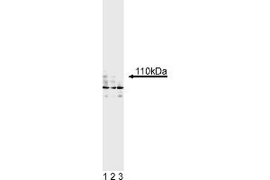 Western Blotting (WB) image for anti-Androgen Receptor (AR) antibody (ABIN967444)