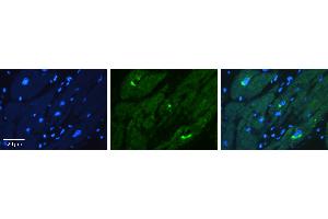 Rabbit Anti-KAT5 Antibody Catalog Number: ARP38792_P050 Formalin Fixed Paraffin Embedded Tissue: Human heart Tissue Observed Staining: Cytoplasmic Primary Antibody Concentration: 1:100 Other Working Concentrations: 1:600 Secondary Antibody: Donkey anti-Rabbit-Cy3 Secondary Antibody Concentration: 1:200 Magnification: 20X Exposure Time: 0. (KAT5 抗体  (C-Term))
