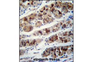 PCIA1 Antibody (Center) (ABIN658015 and ABIN2846953) immunohistochemistry analysis in formalin fixed and paraffin embedded human stomach tissue followed by peroxidase conjugation of the secondary antibody and DAB staining. (DDA1 抗体  (AA 11-40))