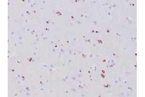 Formalin-fixed, paraffin-embedded human cerebrum stained with OLIG2 Recombinant Rabbit Monoclonal Antibody (OLIG2/6695R). (Recombinant OLIG2 抗体  (AA 200-300))