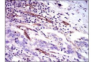 Immunohistochemistry (IHC) image for anti-CD59 (CD59) (AA 31-111) antibody (ABIN1845905) (CD59 抗体  (AA 31-111))