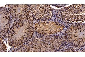 Immunohistochemistry (IHC) image for anti-Chromobox Homolog 3 (CBX3) (AA 1-183) antibody (ABIN7434851)
