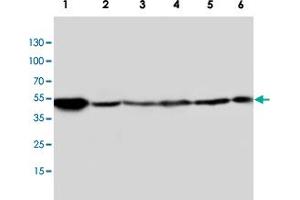 Western blot analysis of tissue and whole cell extracts with HTR2A polyclonal antibody . (HTR2A 抗体  (C-Term))