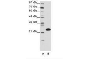Image no. 1 for anti-TATA Box Binding Protein Associated Factor 11 (TAF11) (N-Term) antibody (ABIN6736151) (TAF11 抗体  (N-Term))