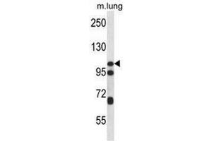 CTNND2 Antibody (C-term) western blot analysis in mouse lung tissue lysates (35µg/lane). (CTNND2 抗体  (C-Term))