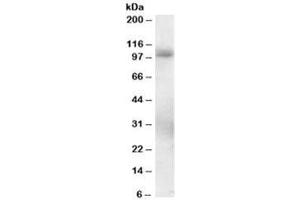 Western blot testing of human lung lysate with PDE5 antibody at 0. (PDE5A 抗体)