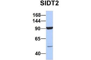 Western Blotting (WB) image for anti-SID1 Transmembrane Family, Member 2 (SIDT2) (N-Term) antibody (ABIN2778621)
