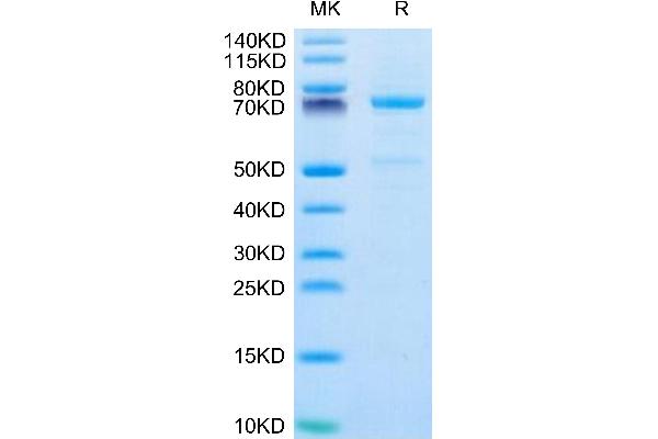 P-Cadherin Protein (CDH3) (AA 108-654) (His tag)