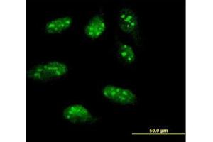Image no. 1 for anti-LIM Homeobox 1 (LHX1) (AA 1-101) antibody (ABIN598782) (LHX1 抗体  (AA 1-101))
