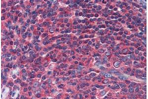 Human Tonsil (formalin-fixed, paraffin-embedded) stained with NPY1R antibody ABIN462232 followed by biotinylated goat anti-rabbit IgG secondary antibody ABIN481713, alkaline phosphatase-streptavidin and chromogen. (NPY1R 抗体  (AA 180-229))