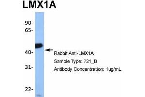 Host: Rabbit  Target Name: TRIM10  Sample Tissue: 721_B  Antibody Dilution: 1. (LMX1A 抗体  (Middle Region))