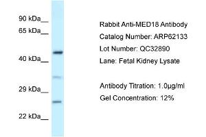 Western Blotting (WB) image for anti-Mediator Complex Subunit 18 (MED18) (Middle Region) antibody (ABIN2789031)